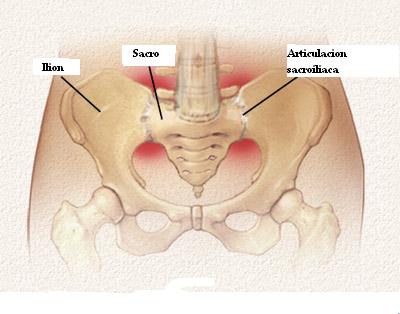 HABLEMOS DEL DOLOR SACROILIACO BLOG SOBRE LA PATOLOGIA DEL RAQUIS y el sentido común aplicado