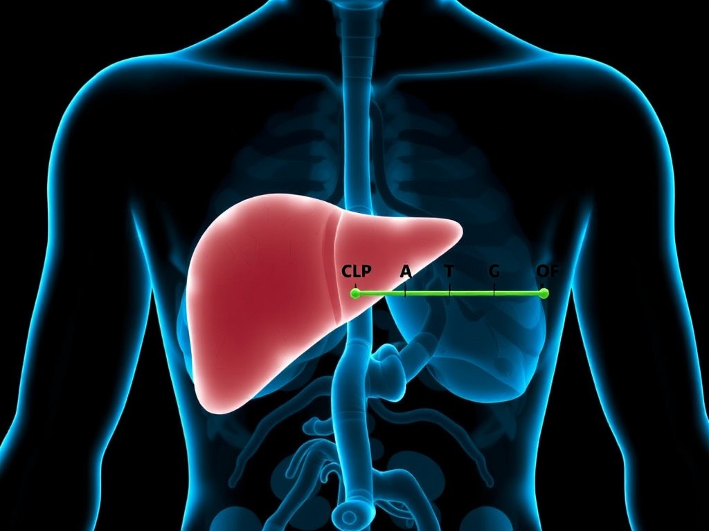 11_20_24_How-to-limit-the-amount-of-cholesterol-that-the-liver-creates-80-percent-of-all-cholesterol.jpeg