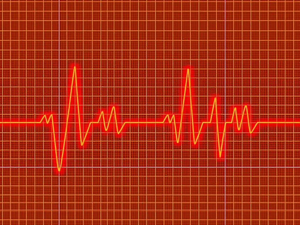 8_26_24_specific-ECG-changes-that-can-predict-the-progression-or-prognosis-of-heart-failure.jpeg